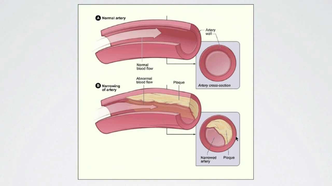 055 Regulating Peripheral Resistance - Part 1 | Interactive Biology ...