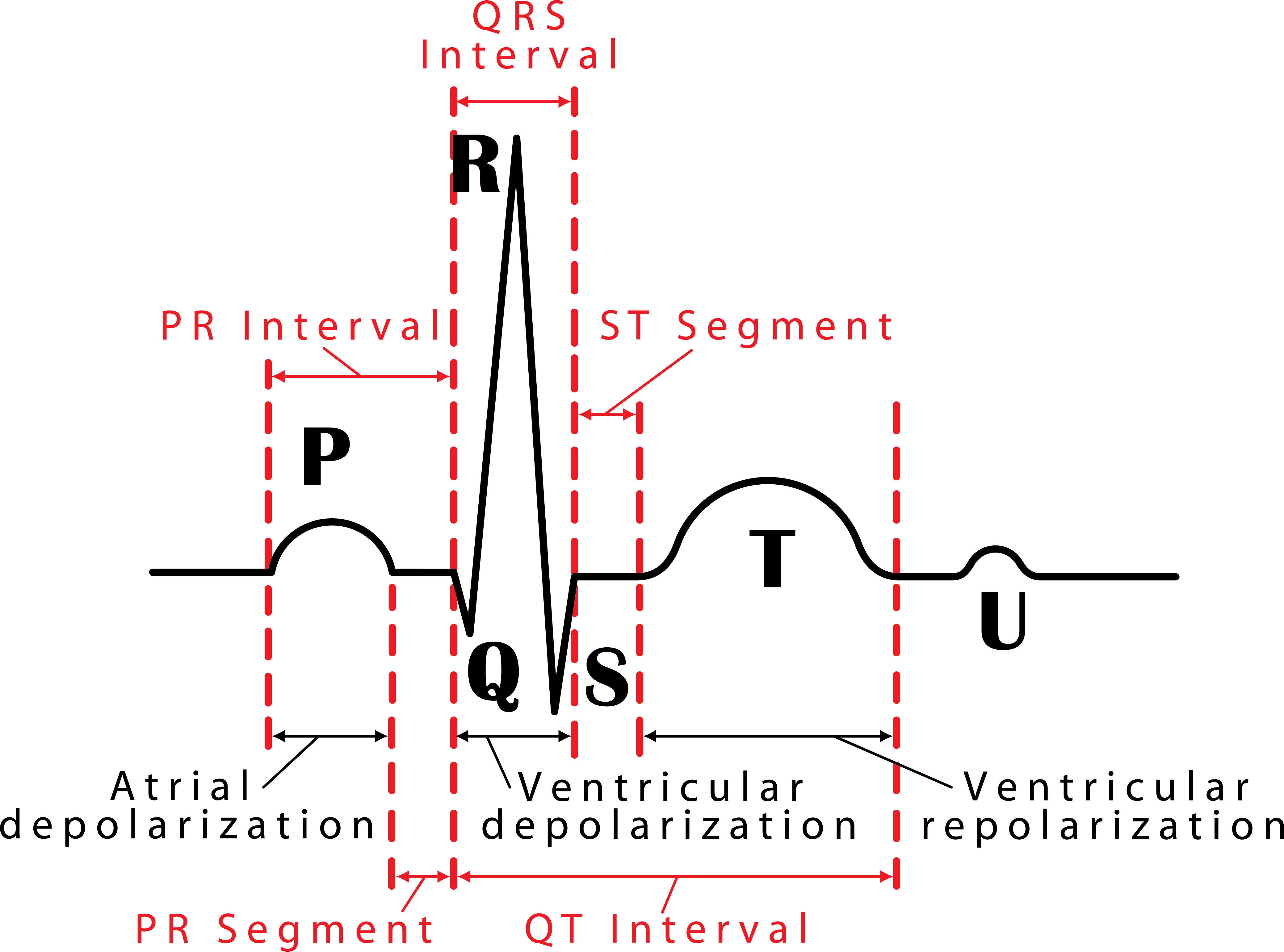 Normal Ecg Labeled Normal Ecg Labeled